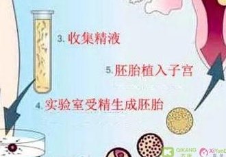 2026北京的乌克兰试管婴儿机构靠谱吗？乌克兰试管医院