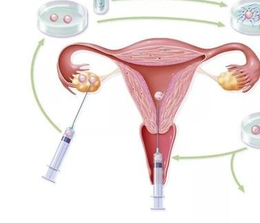 2026南平试管婴儿怀孕指导，找医院／估费用／查成功率